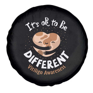 Vitiligo Awareness Spare Tire Cover Its Ok To Be Different TS09 Print Your Wear