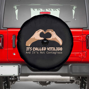 Vitiligo Awareness Spare Tire Cover It's Called Vitiligo And It's Not Contagious TS09 Black Print Your Wear