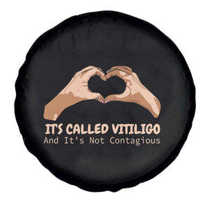Vitiligo Awareness Spare Tire Cover It's Called Vitiligo And It's Not Contagious TS09 Print Your Wear