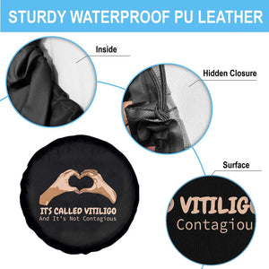 Vitiligo Awareness Spare Tire Cover It's Called Vitiligo And It's Not Contagious TS09 Print Your Wear