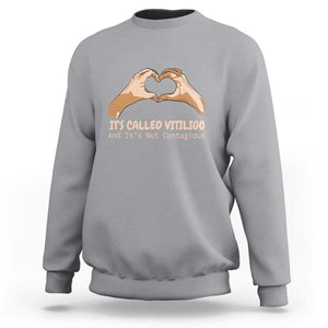 Vitiligo Awareness Sweatshirt It's Called Vitiligo And It's Not Contagious TS09 Sport Gray Print Your Wear