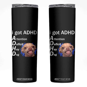 Funny ADHD Dog Meme Skinny Tumbler Attention Deficit Hey Dog Humor Lovers TS10 Black Print Your Wear