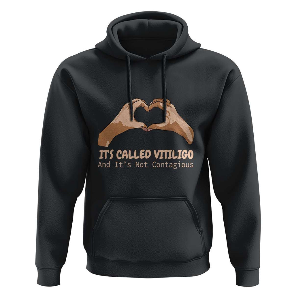 Vitiligo Awareness Hoodie It's Called Vitiligo And It's Not Contagious TS09 Black Print Your Wear