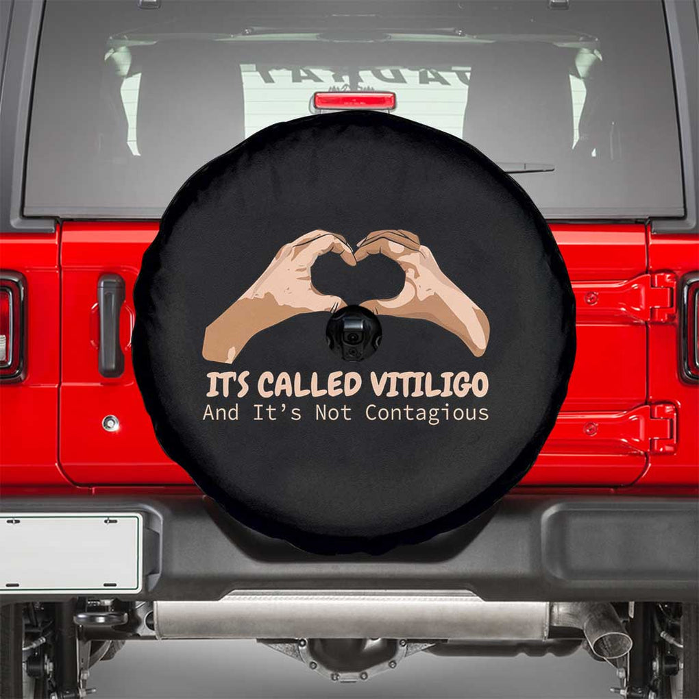 Vitiligo Awareness Spare Tire Cover It's Called Vitiligo And It's Not Contagious TS09 Black Print Your Wear
