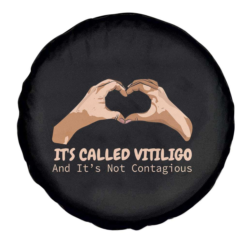 Vitiligo Awareness Spare Tire Cover It's Called Vitiligo And It's Not Contagious TS09 Print Your Wear