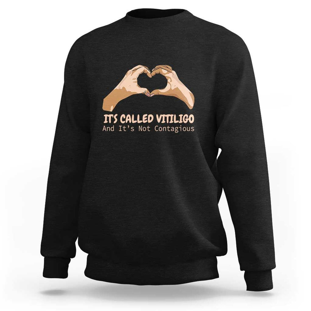 Vitiligo Awareness Sweatshirt It's Called Vitiligo And It's Not Contagious TS09 Black Print Your Wear