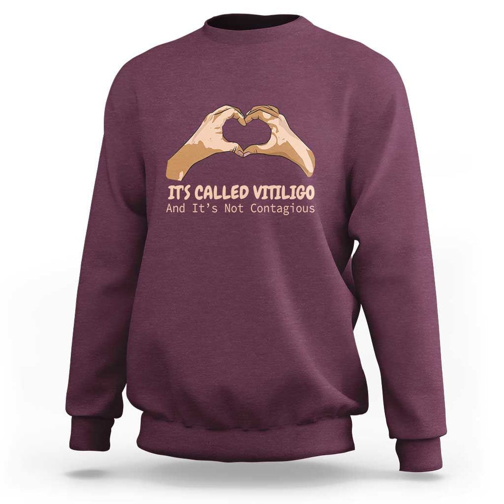 Vitiligo Awareness Sweatshirt It's Called Vitiligo And It's Not Contagious TS09 Maroon Print Your Wear