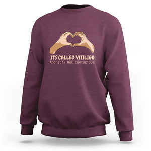 Vitiligo Awareness Sweatshirt It's Called Vitiligo And It's Not Contagious TS09 Maroon Print Your Wear