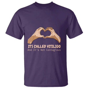 Vitiligo Awareness T Shirt It's Called Vitiligo And It's Not Contagious TS09 Purple Print Your Wear